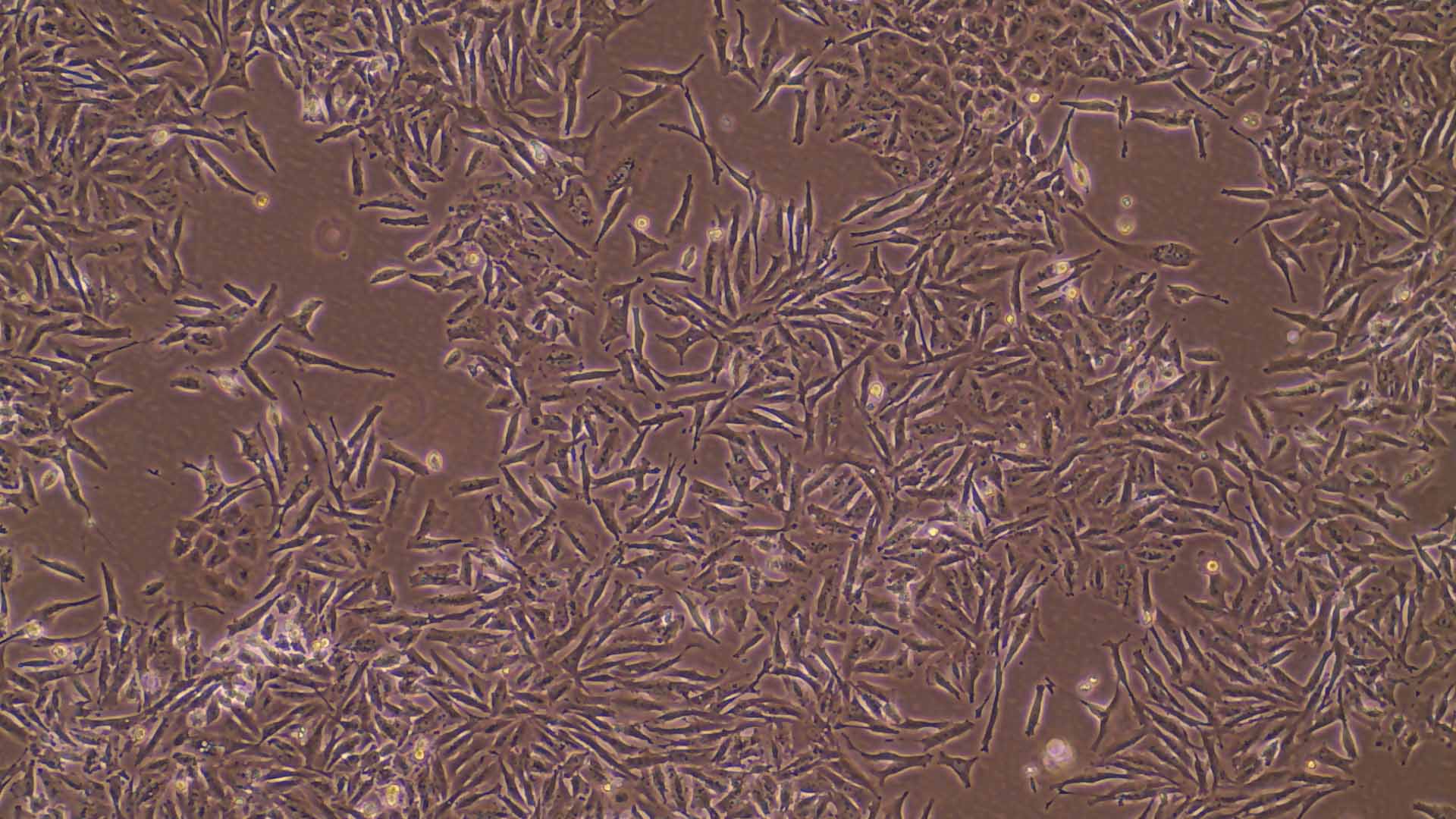 Breast cancer cells