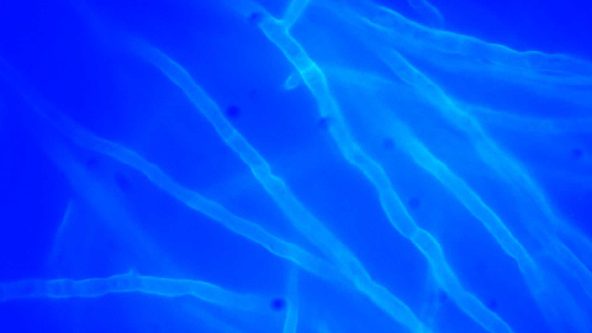 bacteria sample stained blue