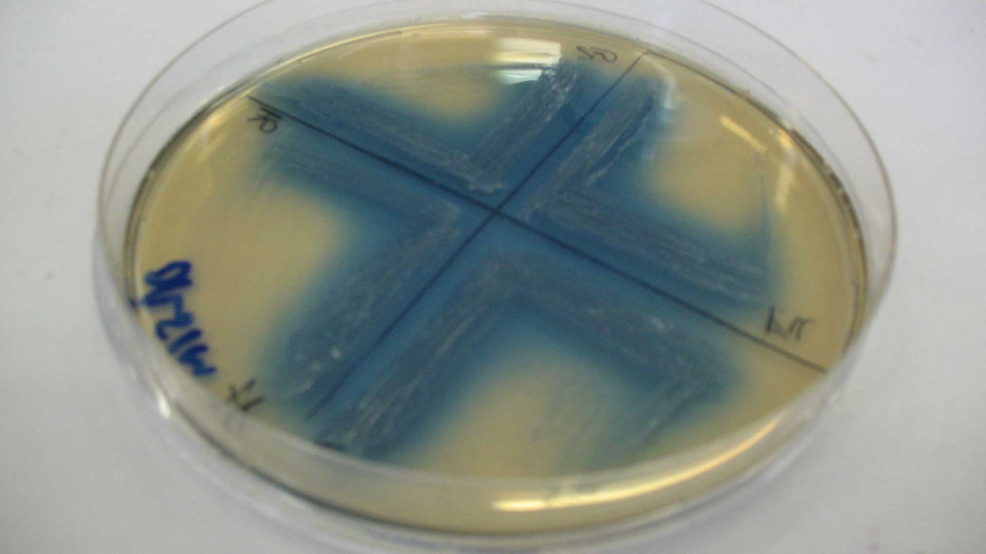 Bacteria/virus sample in a petri dish